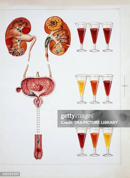 Urinary System Rq 329 Urine Cells Stock Photos, High-Res Pictures, and Images - Getty Images