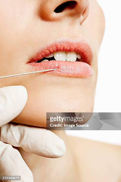 young woman having lip injection - painful lips stock pictures, royalty-free photos & images