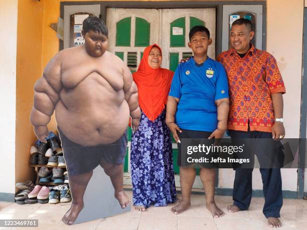 Aria Permana, 13 years old, who previously weighed 192 kilograms took a photo with his parents and a replica of his body when he was still obese in...