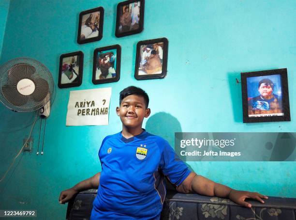 Aria Permana, 13 years old, who previously weighed 192 kilograms posed in his house in Karawang. ONCE known as the heaviest child in the world, Arya...