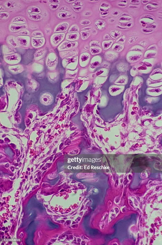 ENDOCHONDRAL BONE, ENDOCHONDRAL OSSIFICATION---EARLY BONE DEVELOPMENT in the EPIPHYSEAL DISK region, 100X
