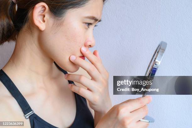 portrait of asian woman worry about her face when she saw the problem of acne inflammation and scar by the mini mirror. - inflammation woman stock pictures, royalty-free photos & images