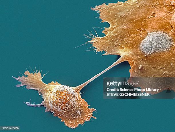 pancreatic cancer cells, sem - microscopia eletrônica de varredura - fotografias e filmes do acervo