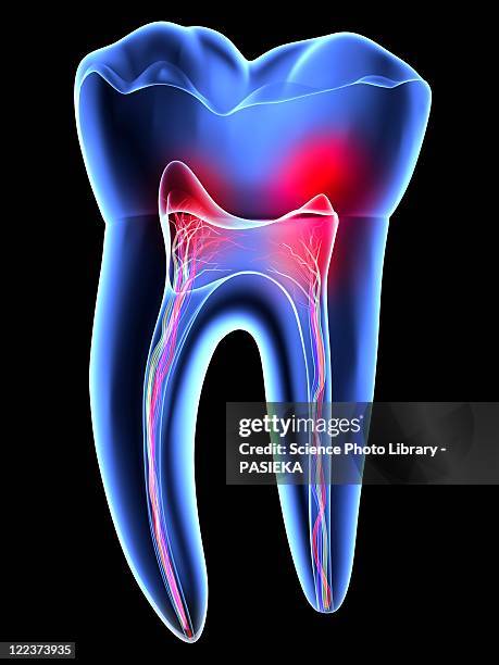 tooth pain, toothache - zahn stock-grafiken, -clipart, -cartoons und -symbole