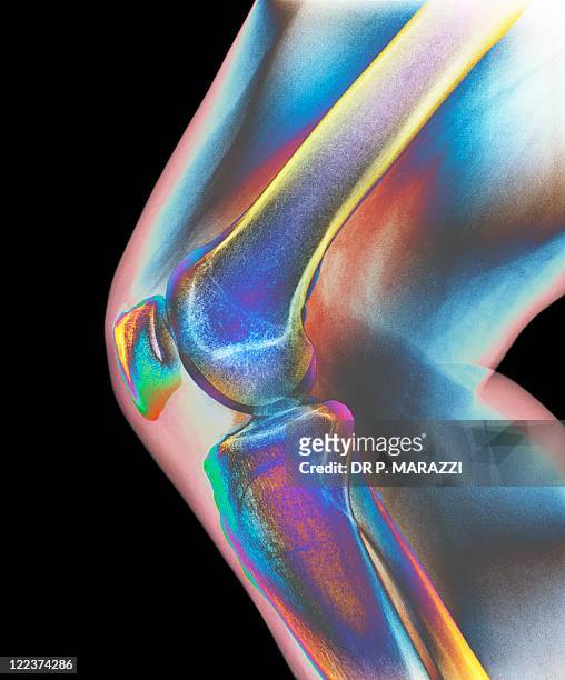 normal knee, x-ray - human knee stock pictures, royalty-free photos & images