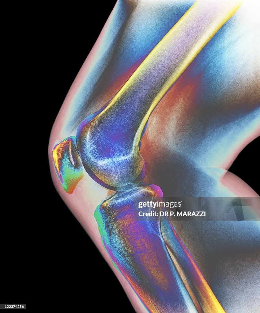 Normal knee, X-ray