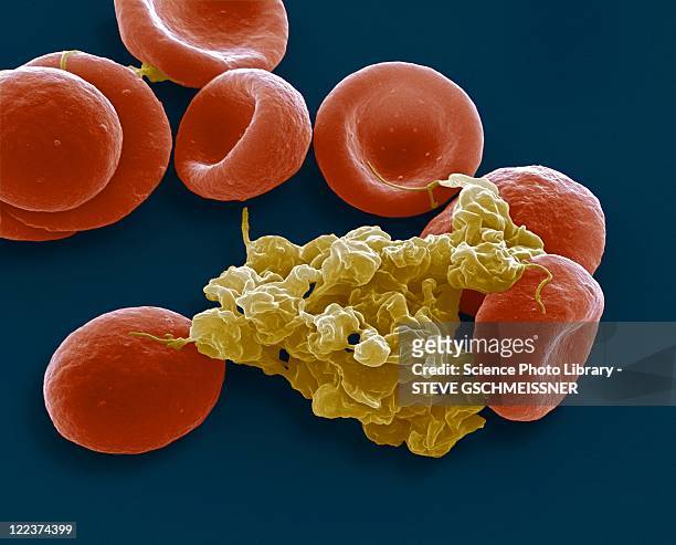 blood cells, sem - micrografía electrónica escaneadora fotografías e imágenes de stock