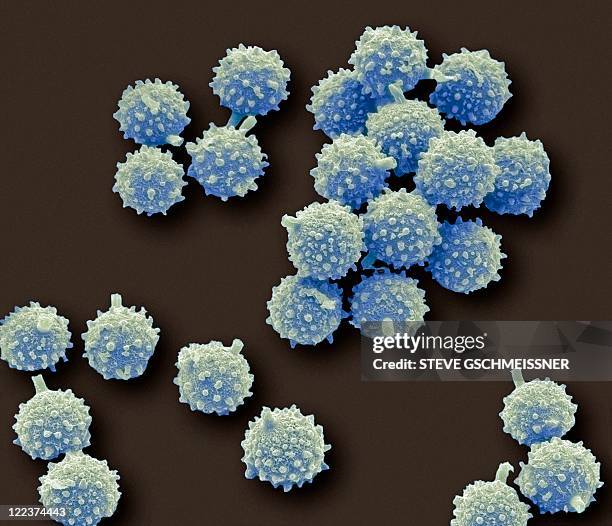 Gleba Puffball Spores Photos and Premium High Res Pictures - Getty Images