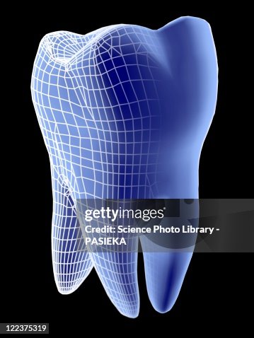 Molar tooth Molar tooth