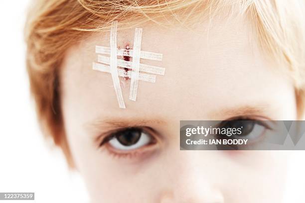 young boy with head wound - head wound stock pictures, royalty-free photos & images