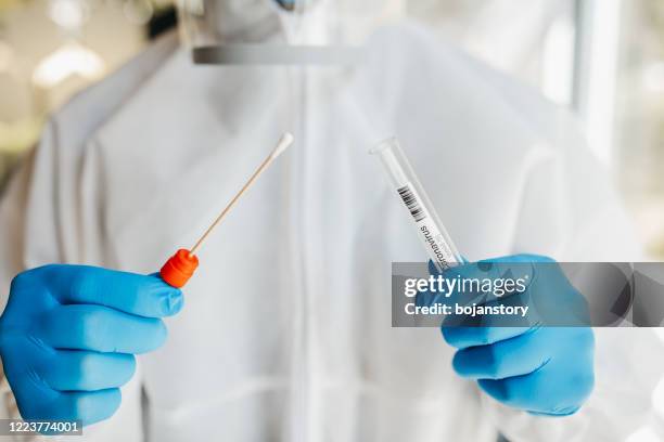 Forensic Swab Collection Forensic Testing Photos and Premium High Res Pictures - Getty Images