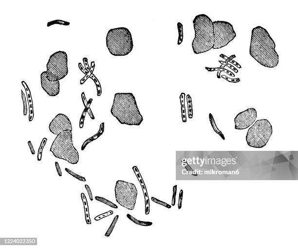 old engraved illustration of tuberculosis (tb), micro-organisms, germ theory of disease - bakterie stock pictures, royalty-free photos & images