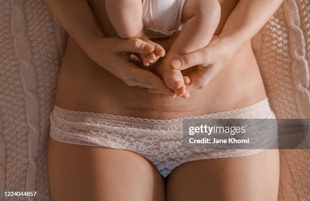 c-section scar and newborn baby - woman delivering baby stock pictures, royalty-free photos & images