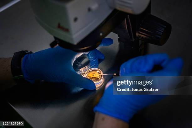 Inside a lab at a clinic in Tbilisi, Georgia, Doctor Jordan from Spain, is doing an artificial insemination into an egg that later will be planted...