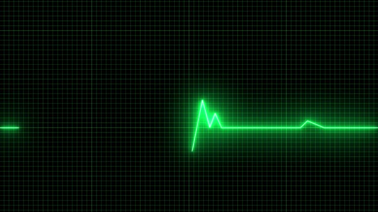 17,374 Heartbeat Videos and HD Footage - Getty Images 17,374 Heartbeat Videos and HD Footage - Getty Images