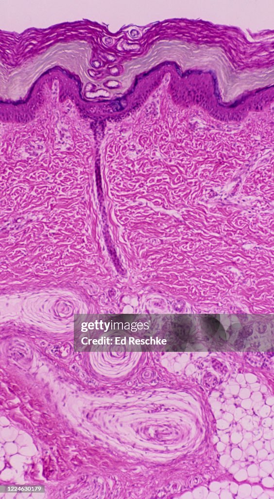 ANATOMY of the SKIN--EPIDERMIS, DERMIS and SUBCUTANEOUS LAYER, or HYPODERMIS, 40X
