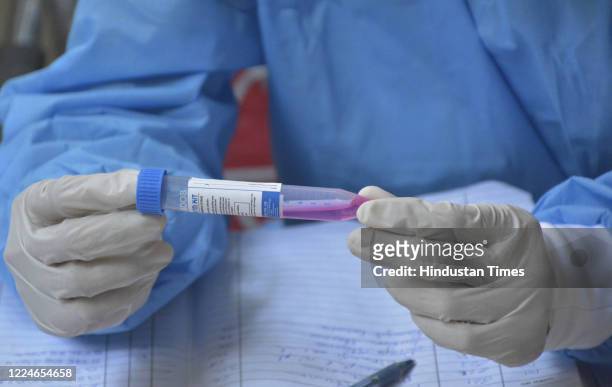 Medical worker handles a swab sample placed in a transport container for Covid-19 rapid testing at the MMG district hospital, on July 4, 2020 in...