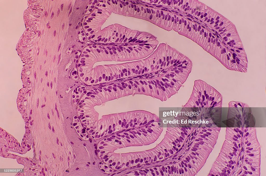 SMALL INTESTINE showing LAYERS---MUCOSA, SUBMUCOSA, MUSCULAR LAYER, SEROSA and SIMPLE COLUMNAR EPITHELIUM with GOBLET CELLS, 25X