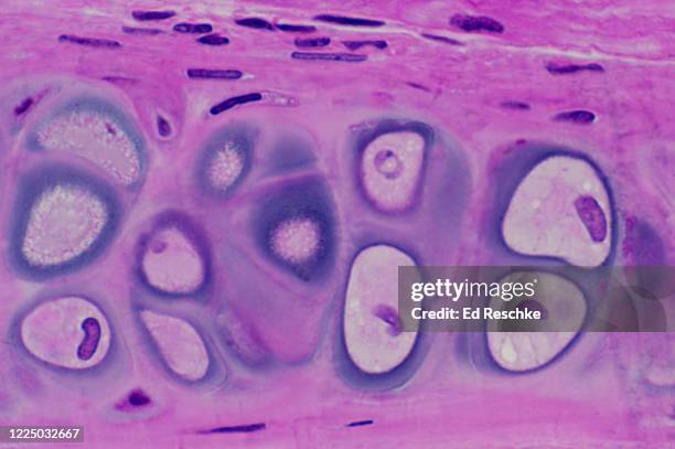 Hyaline Inclusions 53 Hyaline Cartilage Connective Tissue Stock Photos, High-Res Pictures ...