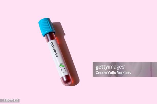 covid-19 positive test tube on the pink background - blood tubes stockfoto's en -beelden