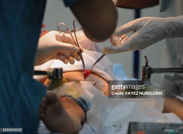 Algerian doctors circumcise a boy during a mass circumcision at a local hospital September 27, 2008. In Algiers. The Muslim religion stresses...
