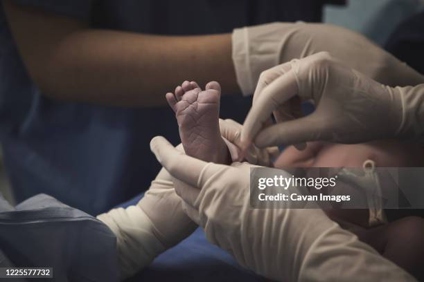 first moment of a newborn, labor in a hospital. after birth. - baby delivery photos et images de collection