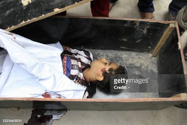 The body of an Iraqi boy killed during fights between US troops and militants in Baghdad's Sadr City neighborhood lies in a coffin, 21 October 2007....