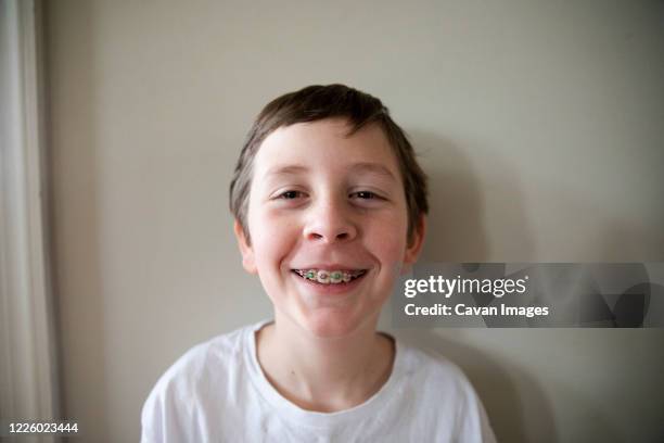 tween boy with red and green braces grins at camera, close up - boys with braces stock pictures, royalty-free photos & images