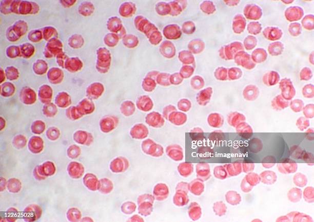 Artifact In Rbc 381 Red Blood Cell Micrograph Stock Photos, High-Res Pictures, and ...