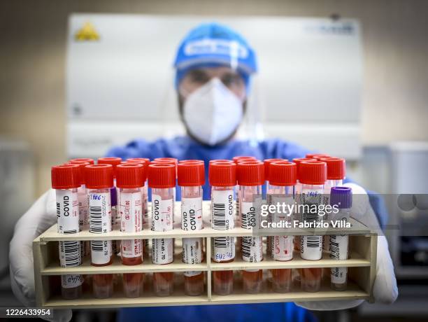Test tubes containing blood samples to detect the presence of Covid-19 are seen in the molecular biology laboratory of Cannizzaro Hospital on May 22,...