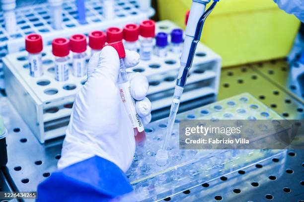 The molecular biology laboratory of Cannizzaro Hospital in Catania during the analysis of biological samples to detect the presence of Covid-19 on...