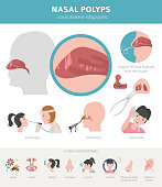 Nasal diseases. Nasal polyps causes, diagnosis and treatment medical infographic design