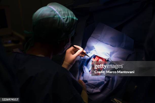 The neurosurgeon exposes the brain during surgery on May 25, 2020 in Cremona, Italy. This is the first neurosurgery at Cremona Hospital after the...