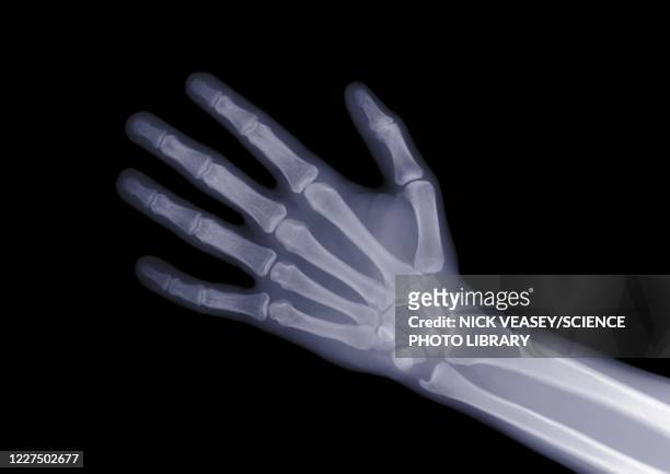 open hand, x-ray - x ray arm stock pictures, royalty-free photos & images
