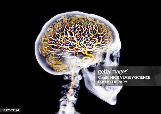 skull showing brain and neurons, x-ray - skull xray no brain stock pictures, royalty-free photos & images