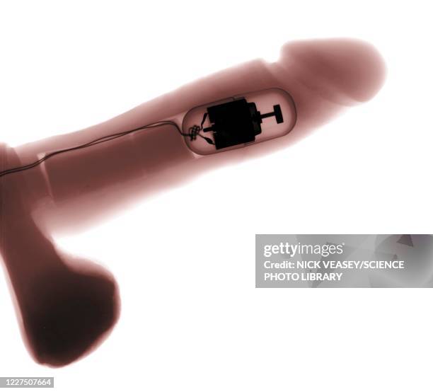 motorised vibrator, x-ray - testis stock pictures, royalty-free photos & images