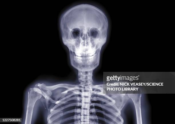 skull and shoulders smiling, x-ray - benton bildbanksfoton och bilder
