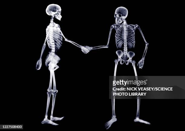 two skeletons shaking hands, x-ray - braccio umano foto e immagini stock