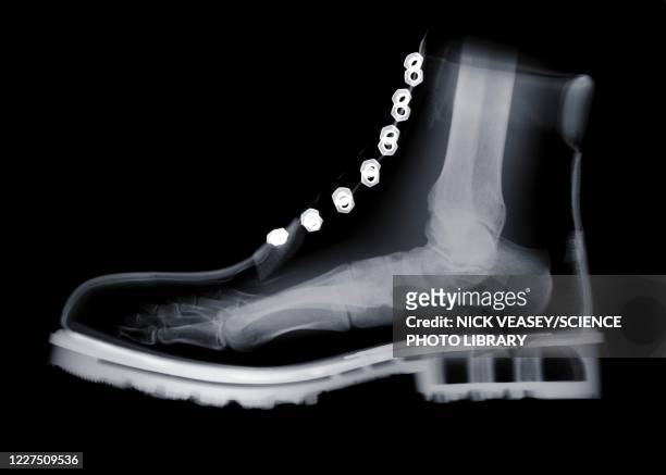 human foot inside boot, x-ray - x ray body stock pictures, royalty-free photos & images