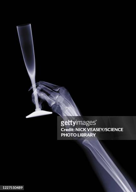 person holding a fluted glass, x-ray - x ray arm stock pictures, royalty-free photos & images