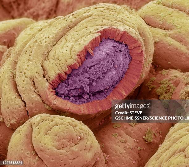 small intestine - lamina propria stock pictures, royalty-free photos & images