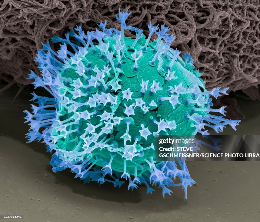 Acanthocystis, SEM