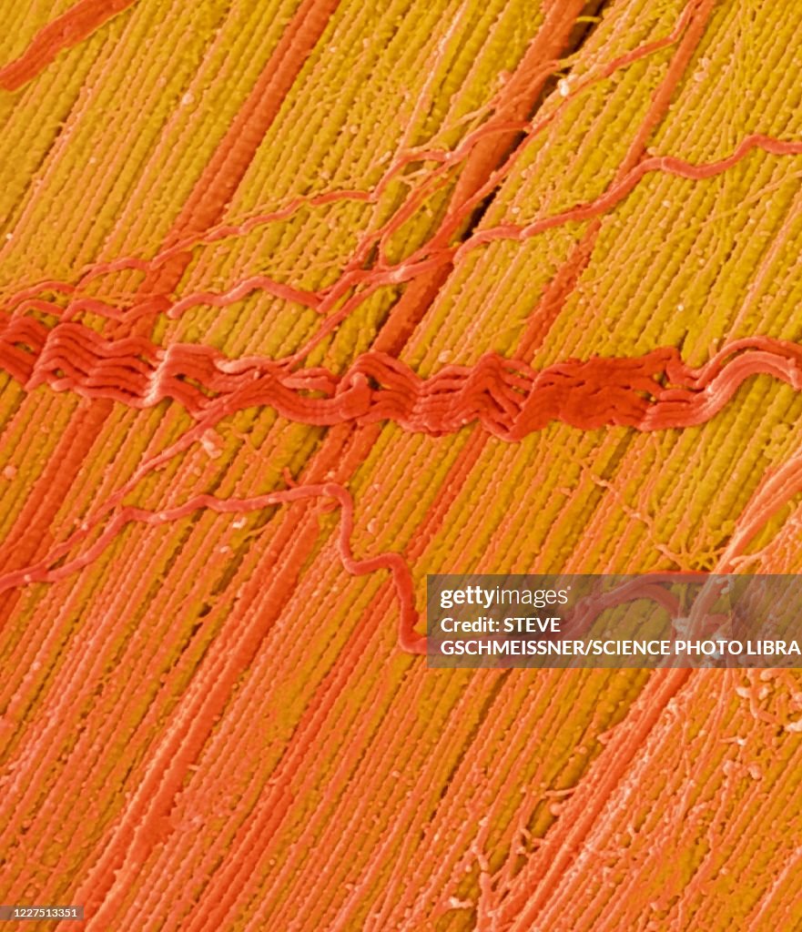 Tendon, SEM