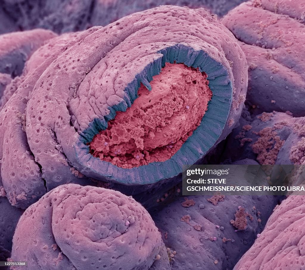 Small intestine, SEM