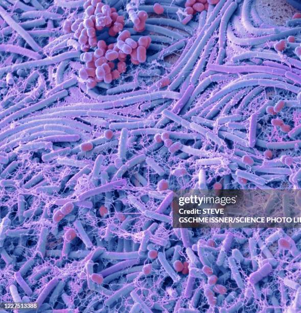 bacteria from a coin, sem - メチシリン耐性黄色ブドウ球菌 ストッ�クフォトと画像