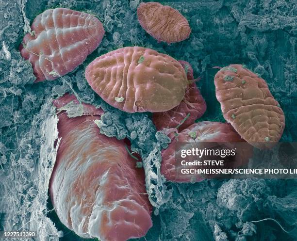 Scale Insects Microscope 41 Scale (Zoology) Stock Photos, High-Res Pictures, and Images - Getty ...