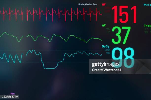 close-upof ekg screen display - electrocardiogram chart stock pictures, royalty-free photos & images