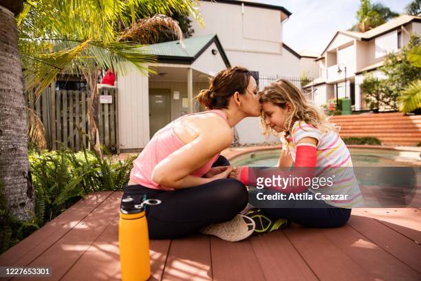 mother giving kiss to injured daughter in cast at pool - ingessatura foto e immagini stock