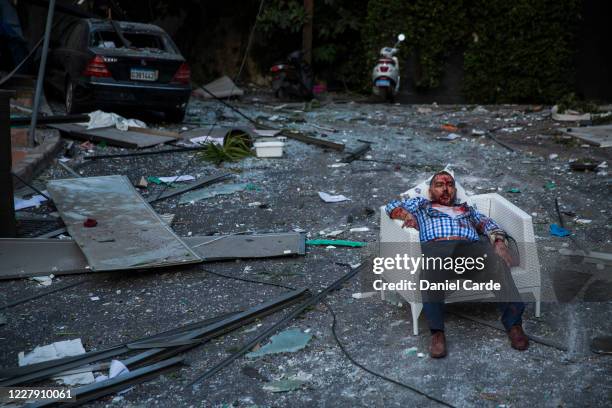 An injured man rests in a chair after a large explosion on August 4, 2020 in Beirut, Lebanon. Video shared on social media showed a structure fire...