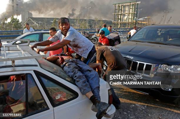 An injured man lies at the back of a car before being rushed away from the scene of a massive explosion at the port of Lebanon's capital Beirut on...